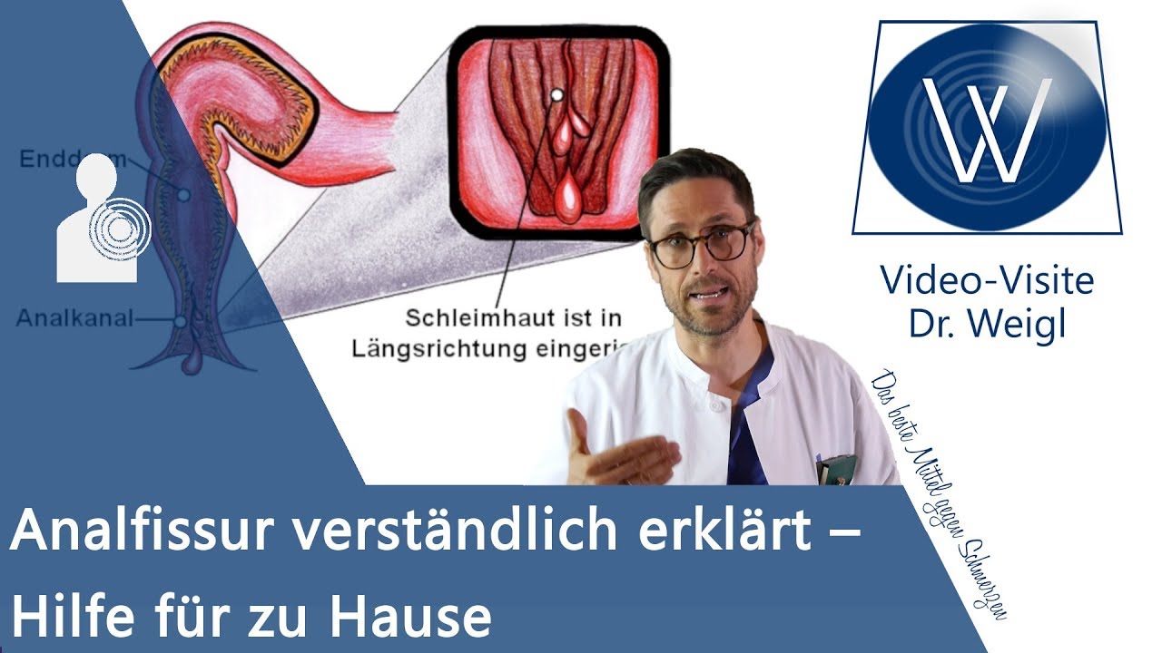 Diagnose Afterriss🙊 Schmerzhaft juckende Analfissur behandeln & Schmerzen beim Stuhlgang reduzieren