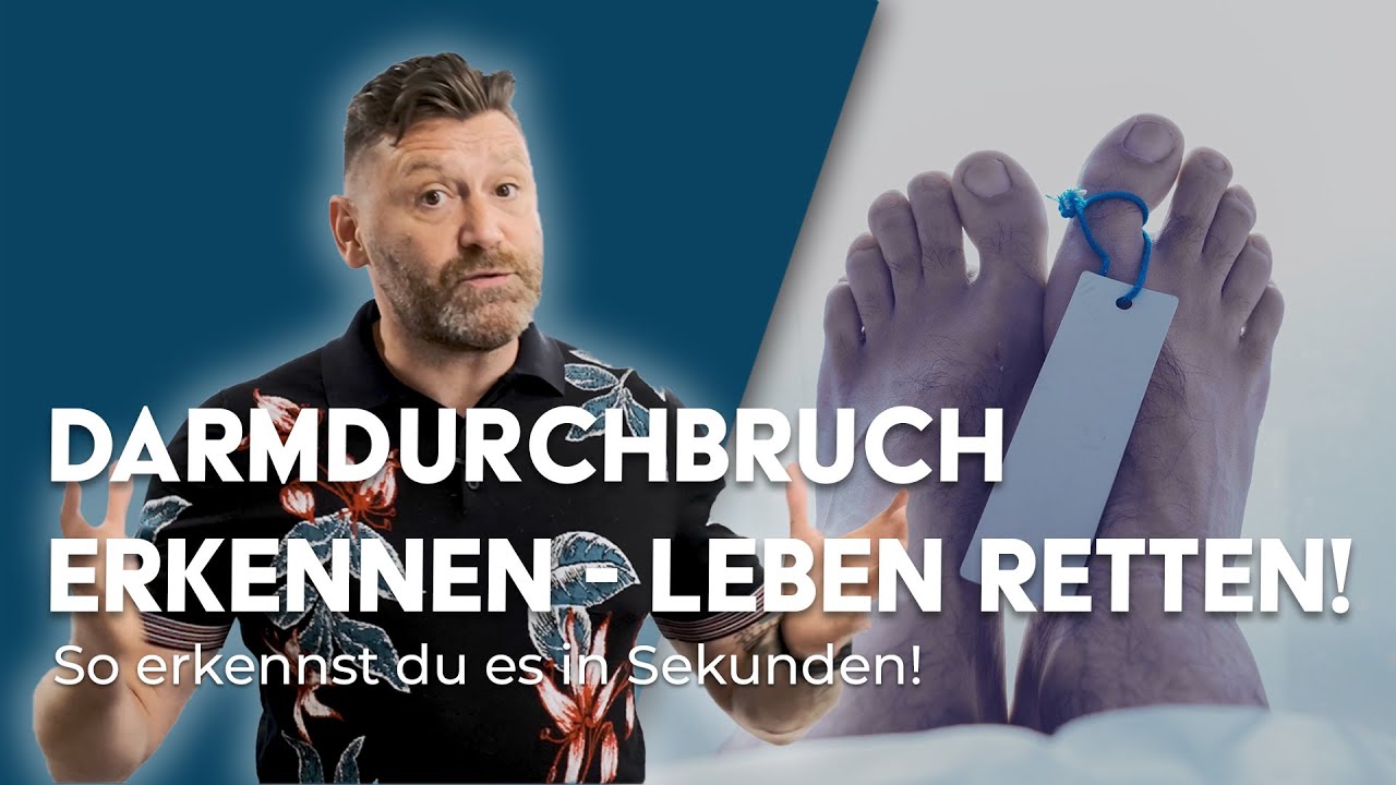 GEFAHR Darmdurchbruch - Ursachen, Symptome und Behandlung (Proktologe klärt auf)
