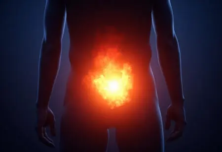 eine abstrakte darstellung des unterleibs mit einem rot glühenden bereich der ein starkes säureartiges brennen symbolisiert